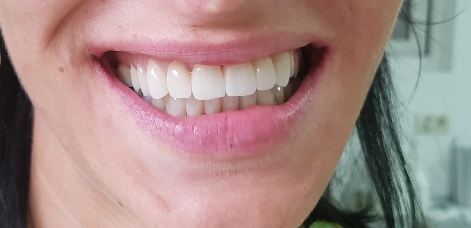 IMG-20180708-WA0000